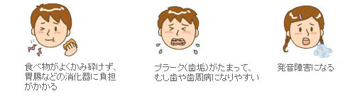 食べ物とよくかみ砕けず、胃腸などの消化器に負担がかかる プラーク（歯垢）がたまって、むし歯や歯周病になりやすい 発音が障害になる